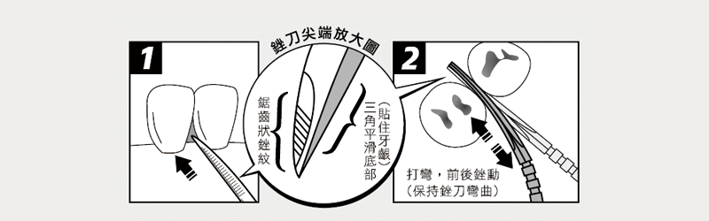 牙籤-銼刀尖端